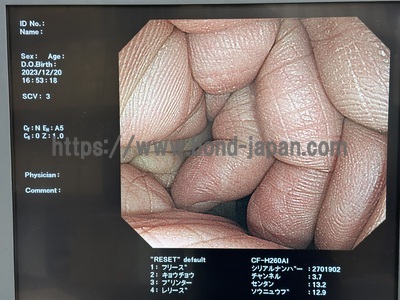 Video Colonoscope&nbsp;|&nbsp;OLYMPUS&nbsp;|&nbsp;CF-H260AI