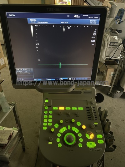 超音波診断装置/カラードプラ&nbsp;|&nbsp;キャノンメディカル株式会社&nbsp;|&nbsp;TUS-X100 Xario 100の写真