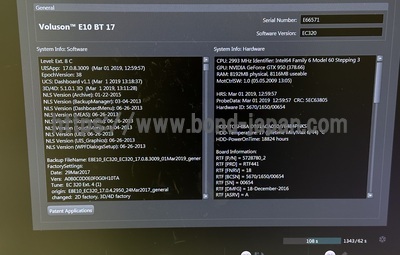 4D Ultrasound&nbsp;|&nbsp;GE&nbsp;|&nbsp;Voluson E10 BT17