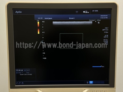 Color Doppler&nbsp;|&nbsp;CANON&nbsp;|&nbsp;Aplio 300