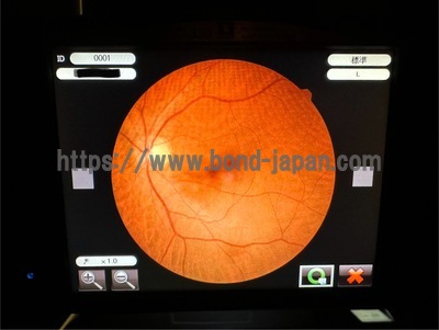 Fundus Camera&nbsp;|&nbsp;NIDEK&nbsp;|&nbsp;AFC-330