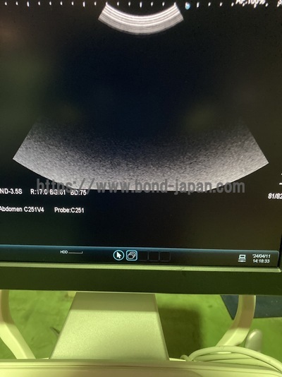 Ultrasound System&nbsp;|&nbsp;HITACHI&nbsp;|&nbsp;ARIETTA 60
