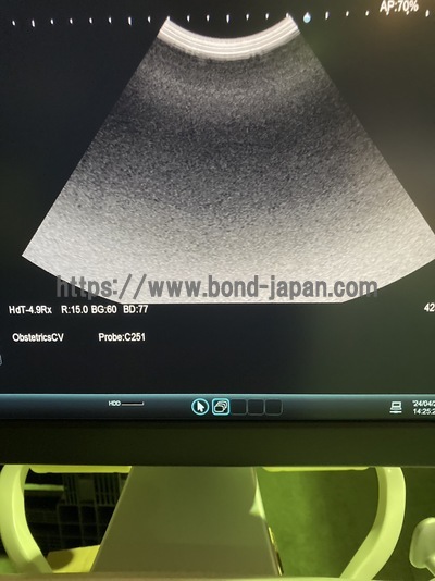 超音波診断装置&nbsp;|&nbsp;日立製作所&nbsp;|&nbsp;ARIETTA 60の写真