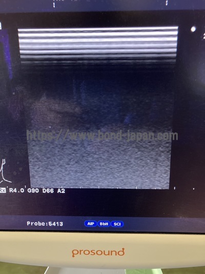 Color Doppler&nbsp;|&nbsp;HITACHI&nbsp;|&nbsp;Prosound α6