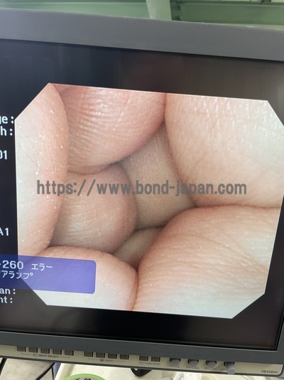 Video Colonoscope&nbsp;|&nbsp;OLYMPUS&nbsp;|&nbsp;CF-Q260AI