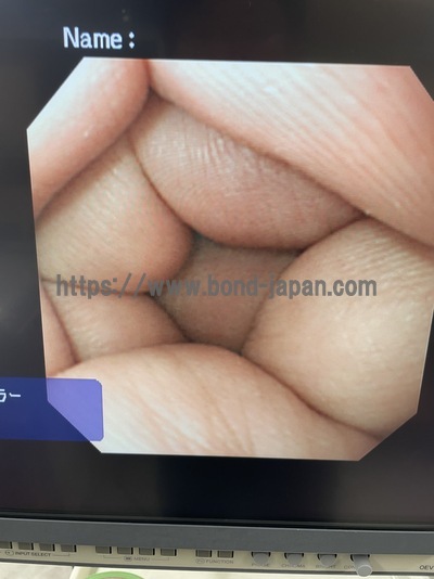 Video Gastroscope&nbsp;|&nbsp;OLYMPUS&nbsp;|&nbsp;GIF-XQ260