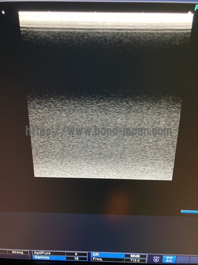 &nbsp;|&nbsp;CANON&nbsp;|&nbsp;TUS-X100S  Xario 100S