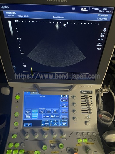 Color Doppler&nbsp;|&nbsp;CANON&nbsp;|&nbsp;Aplio 300
