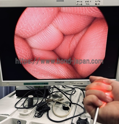 HD Camera System&nbsp;|&nbsp;Stryker&nbsp;|&nbsp;1188HD