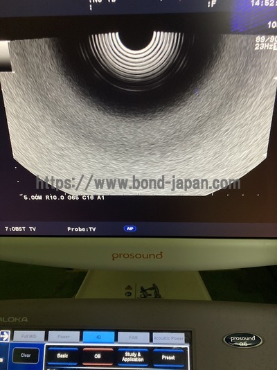 Color Doppler&nbsp;|&nbsp;HITACHI&nbsp;|&nbsp;Prosound α6