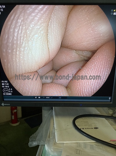 Endosocpy System&nbsp;|&nbsp;FUJIFILM&nbsp;|&nbsp;EPX-3500HD