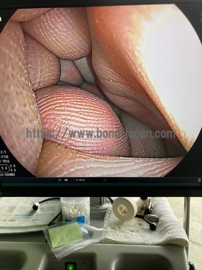 Endoscopy System&nbsp;|&nbsp;FUJIFILM&nbsp;|&nbsp;EPX-4450HD