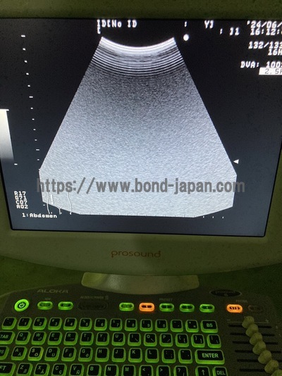 BW System&nbsp;|&nbsp;ALOKA&nbsp;|&nbsp;Prosound 6