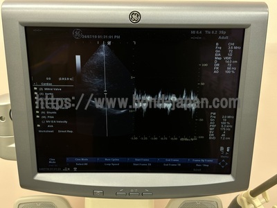 Color Doppler&nbsp;|&nbsp;GE&nbsp;|&nbsp;LOGIQ P5