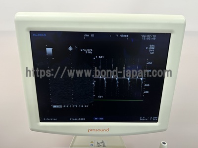 Color Doppler&nbsp;|&nbsp;HITACHI&nbsp;|&nbsp;Prosound α6