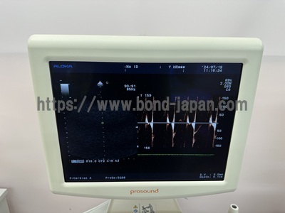 Color Doppler&nbsp;|&nbsp;HITACHI&nbsp;|&nbsp;Prosound α6