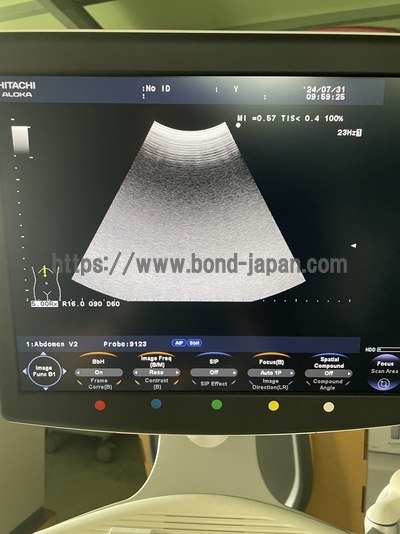 Color Doppler&nbsp;|&nbsp;HITACHI&nbsp;|&nbsp;F37