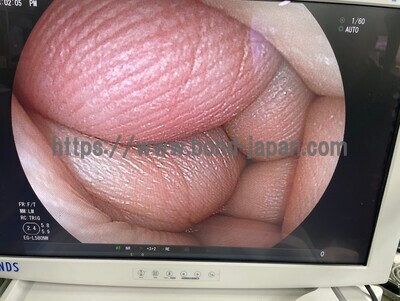 &nbsp;|&nbsp;FUJIFILM&nbsp;|&nbsp;EG-L580NW