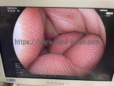 Video Colonoscope&nbsp;|&nbsp;FUJIFILM&nbsp;|&nbsp;EC-L600ZP