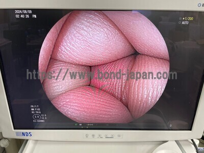 Video Colonoscope&nbsp;|&nbsp;FUJIFILM&nbsp;|&nbsp;EC-590WM3