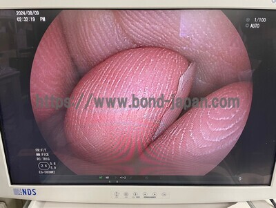 Video Gastroscope&nbsp;|&nbsp;FUJIFILM&nbsp;|&nbsp;EG-580NW2