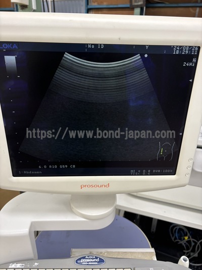 Color Doppler&nbsp;|&nbsp;ALOKA&nbsp;|&nbsp;SSD-3500SX