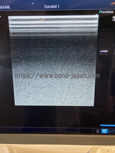 Color Doppler&nbsp;|&nbsp;CANON&nbsp;|&nbsp;Aplio 300