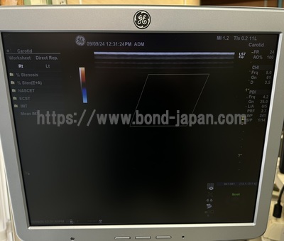 Color Doppler&nbsp;|&nbsp;GE&nbsp;|&nbsp;Logiq S7 Expert