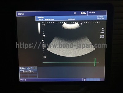 Color Doppler&nbsp;|&nbsp;CANON&nbsp;|&nbsp;TUS-X100 Xario 100