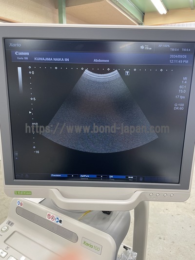 &nbsp;|&nbsp;CANON&nbsp;|&nbsp;TUS-X100S  Xario 100S