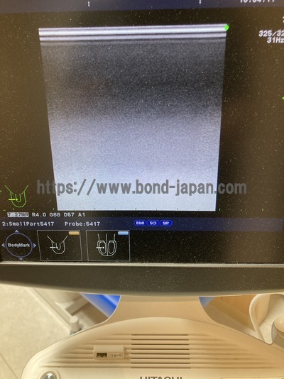 Color Doppler&nbsp;|&nbsp;HITACHI&nbsp;|&nbsp;F37