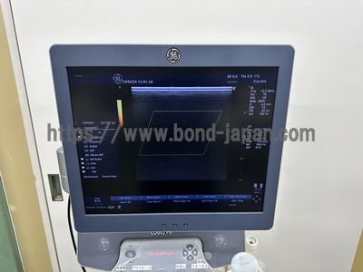 Color Doppler&nbsp;|&nbsp;GE&nbsp;|&nbsp;LOGIQ P6