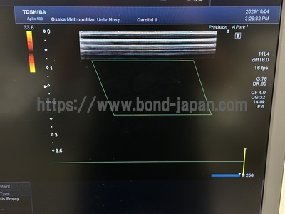 4D Ultrasound&nbsp;|&nbsp;CANON&nbsp;|&nbsp;Aplio 500