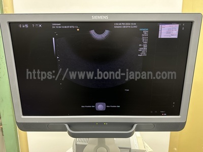 Ultrasound&nbsp;|&nbsp;SIEMENS&nbsp;|&nbsp;Acuson S1000 HELX