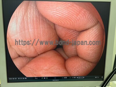 Video Colonoscope&nbsp;|&nbsp;FUJIFILM&nbsp;|&nbsp;EC-590ZW/M