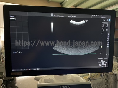 Ultrasound&nbsp;|&nbsp;GE&nbsp;|&nbsp;LOGIQ P9