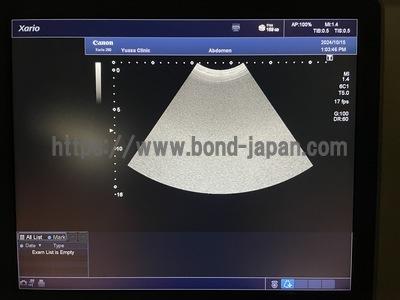 Color Doppler&nbsp;|&nbsp;CANON&nbsp;|&nbsp;Xario 200