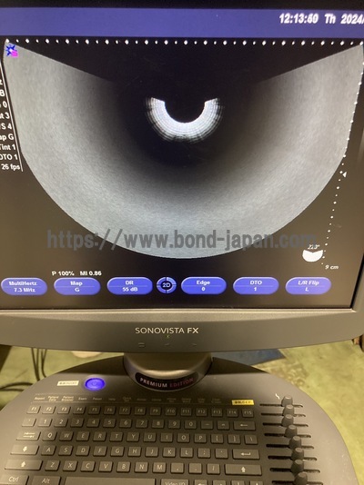 &nbsp;|&nbsp;SIEMENS&nbsp;|&nbsp;Sonovista FX PE
