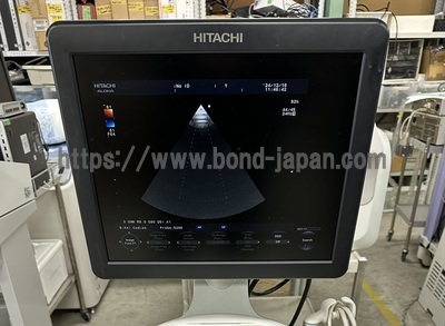 Color Doppler&nbsp;|&nbsp;HITACHI&nbsp;|&nbsp;F37