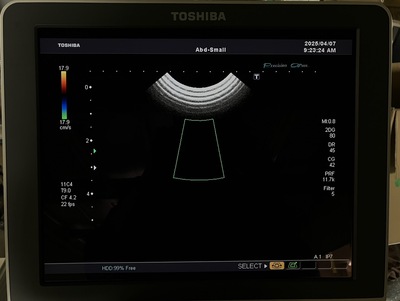 Color Doppler&nbsp;|&nbsp;CANON&nbsp;|&nbsp;SSA-660A Xario