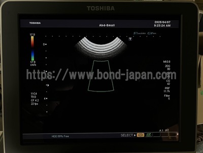Color Doppler&nbsp;|&nbsp;CANON&nbsp;|&nbsp;SSA-660A Xario