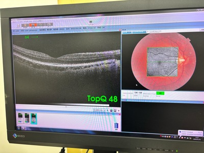OCT&nbsp;|&nbsp;TOPCON&nbsp;|&nbsp;3D OCT 1 / Maestro 1