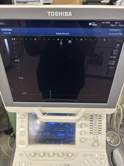 Color Doppler&nbsp;|&nbsp;CANON&nbsp;|&nbsp;Aplio 300