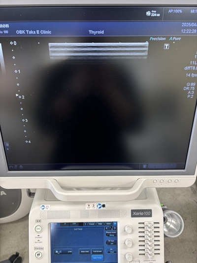 Color Doppler&nbsp;|&nbsp;CANON&nbsp;|&nbsp;TUS-X100 Xario 100