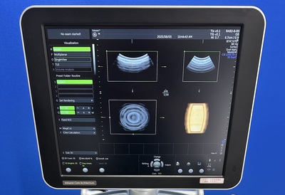 4D Ultrasound&nbsp;|&nbsp;GE&nbsp;|&nbsp;Voluson P8 BT16