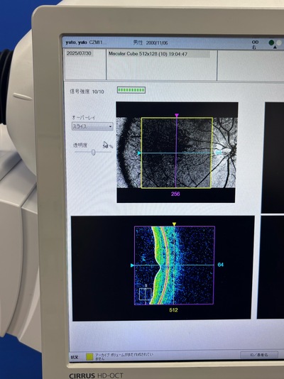 OCT&nbsp;|&nbsp;Carl Zeiss&nbsp;|&nbsp;Cirrus 500 HD-OCT Plus