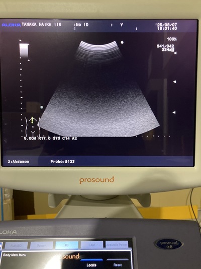 Color Doppler&nbsp;|&nbsp;HITACHI&nbsp;|&nbsp;Prosound α6