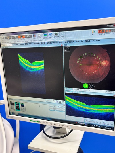 OCT with Non-mydriatic retinal camera&nbsp;|&nbsp;TOPCON&nbsp;|&nbsp;3D OCT 1 / Maestro 1