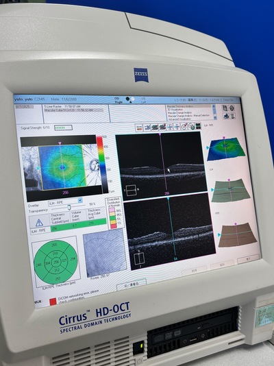 OCT&nbsp;|&nbsp;Carl Zeiss&nbsp;|&nbsp;Cirrus 400 HD-OCT