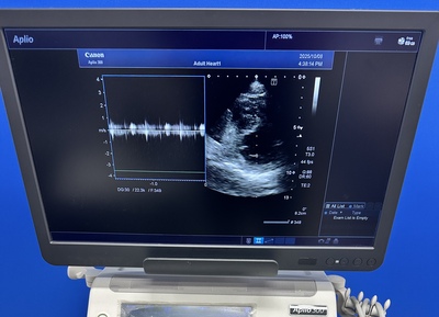 Color Doppler&nbsp;|&nbsp;CANON&nbsp;|&nbsp;Aplio 300